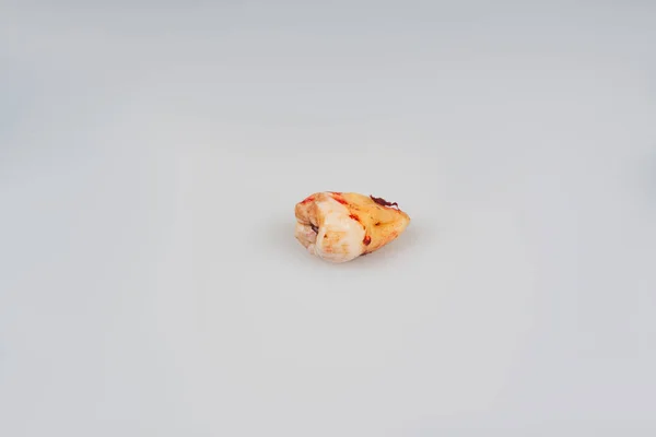 Human wisdom tooth isolated on gray background. Dentistry concept. Macro photo of a wisdom tooth close up