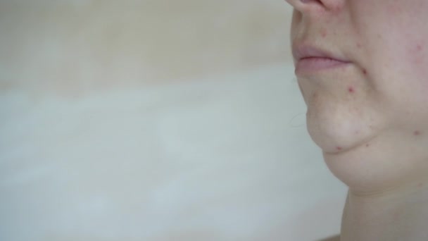 女性のクローズアップは プレーンな背景に2本のあごで顔を サイドビュー 美容の概念 あごのラインの補正 — ストック動画