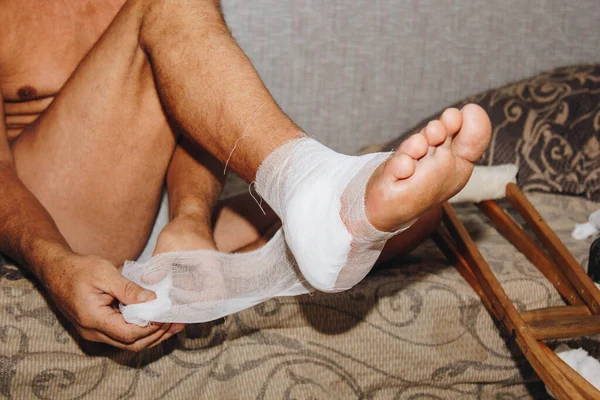 the process of self-bandaging the leg after surgery. Dressing injuries at home