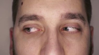 Kılcal damarları olan yeşil gözler. Optalmoloji ve tıp kavramı. Farklı yönlere bakar
