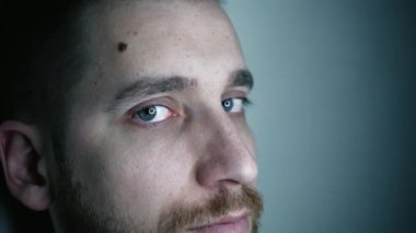 Kılcal damarları olan yeşil gözler. Optalmoloji ve tıp kavramı. Farklı yönlere bakar