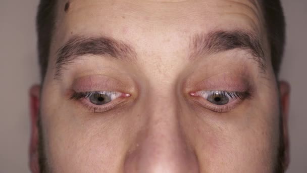 Grüne Augen Großaufnahme Mit Kapillaren Das Konzept Der Augenheilkunde Und — Stockvideo