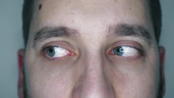 Ojos Verdes Cerca Con Capilares Concepto Oftalmología Medicina Vistas Diferentes — Vídeo de stock