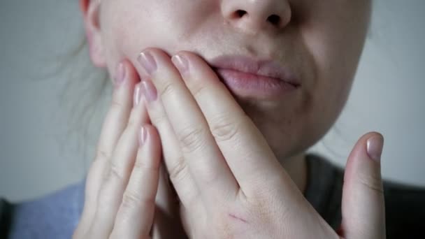皮膚の問題を閉じます にきびやにきびと不健康な皮膚 多孔質 デモデックスと酒 赤い発疹 問題の肌のケアの概念 アレルギー — ストック動画