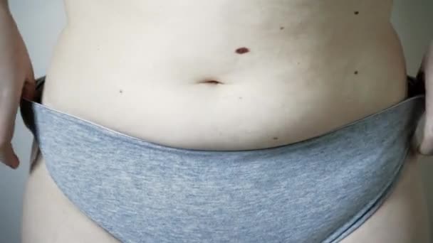 Närbild Fett Veck Den Stora Magen Överviktig Kvinna Begreppet Övervikt — Stockvideo