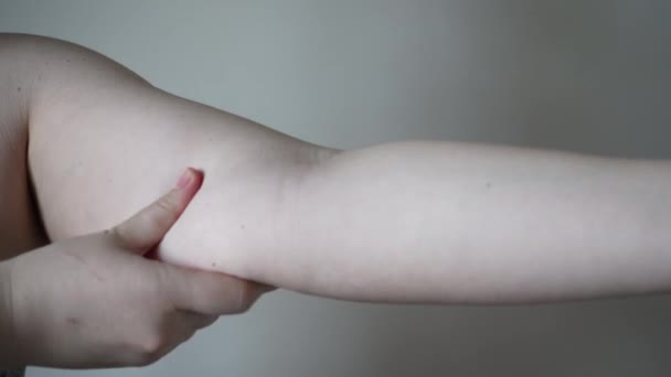 Ljushyad Ung Kvinna Med Hängande Armar Sorglig Dålig Kropp Form — Stockvideo