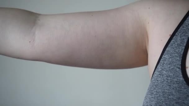 Világos Bőrű Fiatal Lógó Karral Szomorú Rossz Testalkatú Lány Kövér — Stock videók