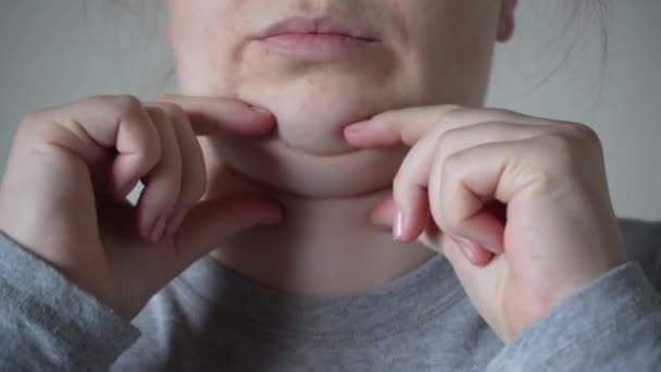 首の下の層状の皮膚を絞る手 女性のあごの下にぶら下がって脂肪組織の問題のあるたるみ ヘルスケアの概念 — ストック動画