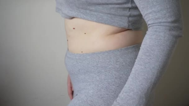 Крупный План Жировых Складок Большом Животе Женщины Избыточным Весом Концепция — стоковое видео