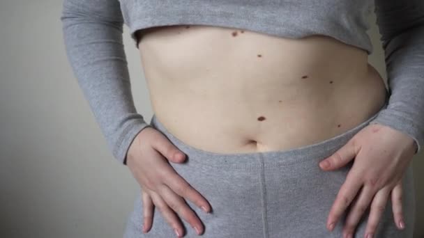 太りすぎの女性の大きな腹に脂肪の折り目のクローズアップ 太りすぎ 女性の肥満 食事や太りすぎの問題の概念 — ストック動画