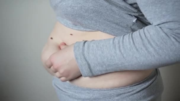 Şişman Bir Kadının Göbeğinde Yağ Kıvrımlarının Yakın Çekimi Aşırı Kilolu — Stok video