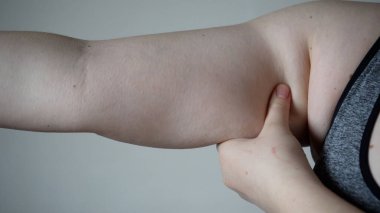 Şişman bir kadının göbeğinde yağ kıvrımlarının yakın çekimi. Aşırı kilolu, kadın obezite, diyet ve aşırı kilo sorunları kavramı