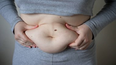 Genç, kilolu ya da şişman, büyük göbekli, cerrahi ve yağ kesme konsepti olan şişman ya da şişman bir kadın.