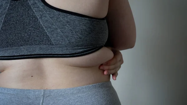 太りすぎの女性の大きな腹に脂肪の折り目のクローズアップ 太りすぎ 女性の肥満 食事や太りすぎの問題の概念 — ストック写真