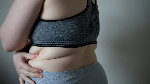 太りすぎの女性の大きな腹に脂肪の折り目のクローズアップ 太りすぎ 女性の肥満 食事や太りすぎの問題の概念 — ストック写真