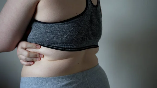 stock image Close-up of fat folds on the large belly of an overweight woman. Concept of overweight, female obesity, dieting and overweight problems