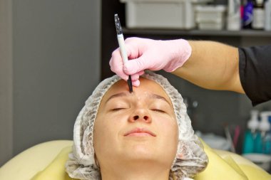 Yüzünde estetik ameliyat talimatları olan çekici bir hasta. Cerrah bir insanın yüzüne dokunuyor. Estetik kozmetoloji ve enjeksiyon kavramı