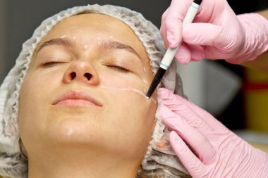 Yüzünde estetik ameliyat talimatları olan çekici bir hasta. Cerrah bir insanın yüzüne dokunuyor. Estetik kozmetoloji ve enjeksiyon kavramı