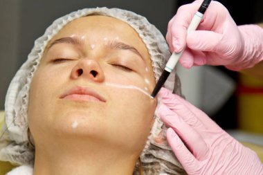 Yüzünde estetik ameliyat talimatları olan çekici bir hasta. Cerrah bir insanın yüzüne dokunuyor. Estetik kozmetoloji ve enjeksiyon kavramı