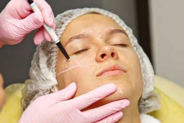 Yüzünde estetik ameliyat talimatları olan çekici bir hasta. Cerrah bir insanın yüzüne dokunuyor. Estetik kozmetoloji ve enjeksiyon kavramı