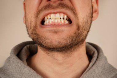 Öfke ve duygu dolu bir adamın yüzüne yakından bakmak. Onun açık ağzı ve kızgın ifadesi duygularının yoğunluğunu iletir. Görüntü, öfkesinin gücünü ve derinliğini vurgular.