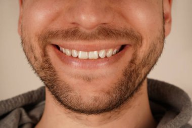 İnce sakallı, erkeksi cazibeli bir adamın çenesinin detaylı bir yakın çekimi. Tıraşsız görünüş zahmetsiz cazibe ve basitlik yayar. Tımar ve günlük stil temaları için mükemmel