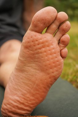 Çıplak ayak, çivili bir tahtanın altında iğne izleri gösteriyor. Çıplak ayakla masaj paspasına yakın çekim, cildin doğal dokusunu ve iyileştirme uygulamalarını vurgulamak.