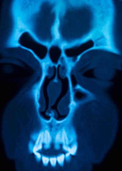 Xray scan skull nose medical exam results from hospital clinic.