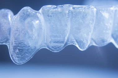 Modern görünmez parantez hizalayıcıları dişçiler tarafından dişlerin hizalanmasını düzeltmek için kullanılır.