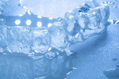 Modern görünmez parantez hizalayıcıları dişçiler tarafından dişlerin hizalanmasını düzeltmek için kullanılır.