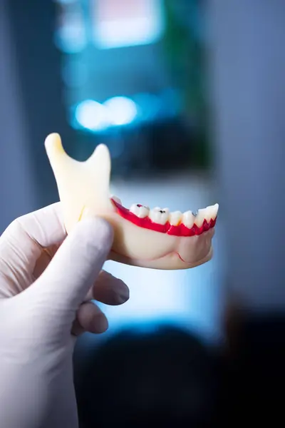 Tooth decay dentists dental model of teeth, gums and root canal