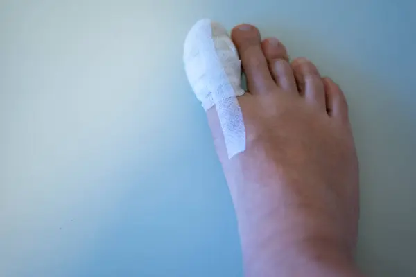 Foot big toe bandage injured feet in medical clinic hospital center.