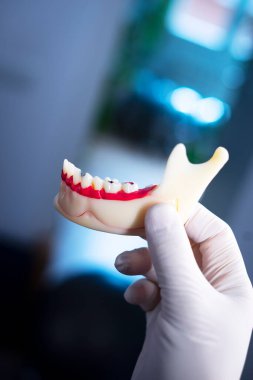 Diş çürüğü, diş eti, diş eti ve kanal tedavisi.