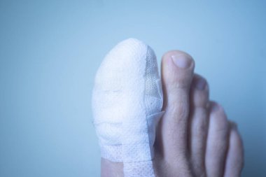 Klinikte ayak parmağı bandajı yaralanmış ayaklar..
