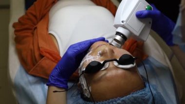 Yüzünde lazer derisi tedavisi, kırışıklıklar için canlandırma tekniği var.