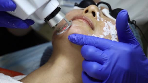 Ansikte Att Laser Skin Treatment Återställningsteknik För Rynkor — Stockvideo