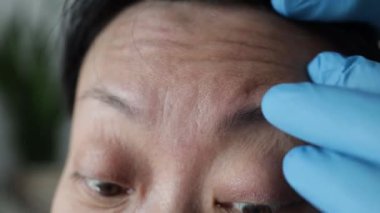 Young woman with wrinkles on her forehead on reception at the beautician, the procedure of rejuvenation.