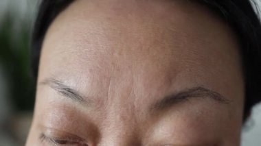 Close-up portrait of Asian woman displeased with wrinkles on her forehead. Sad girl points her finger at the signs of aging