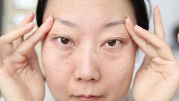 Asian Woman Checks Dark Circles Eyes Worried Female Hands Touch — Vídeos de Stock