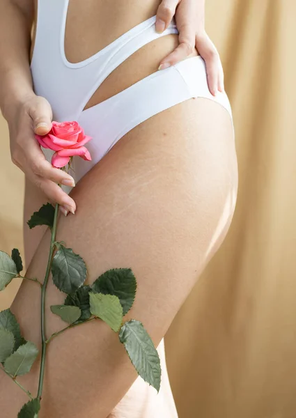 脂肪纤维素和拉伸纹在陈皮女人腿上的应用 女性饮食风格 — 图库照片