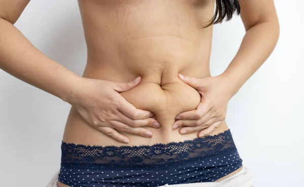 女人肥胖的肚子 肥胖妇女的手握住过多的腹部脂肪 改变饮食生活方式 塑造健康的胃肌肉 演播室匿名拍摄的身体部位照片 — 图库照片
