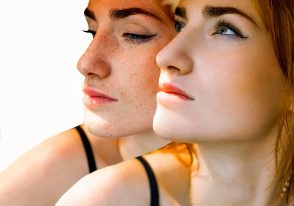 Obrázek Před Místě Melasma Pigmentace Ošetření Obličeje Tváři Ženy Izolované — Stock fotografie