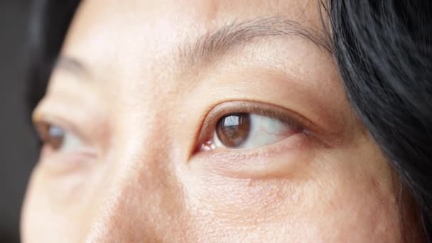 Laserögonkirurgi Närbild Makro Skott Asiatiska Kvinnliga Ögon Tittar Sidan Reklam — Stockvideo