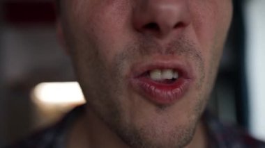 Dişsiz bir erkek ağzının yakın plan çekimi. Kötü dişli bir adam. Çürük dişlerini gösteren bir adam, çürümüş ve çürümüş diş mineleri, dişleri dökülen, diş problemleri...