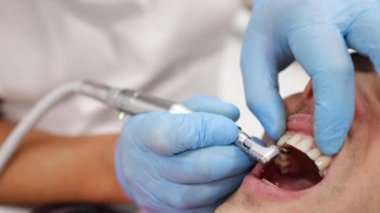 Profesyonel diş temizliği. Doktor dişçinin dişçi muayenehanesinde beyaz gülüşlü, ağır çekim erkek hasta için önleyici derin temizlik prosedürü yaparken yakın çekim.
