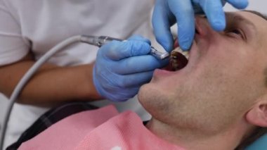 Profesyonel diş temizliği. Doktor dişçinin dişçi muayenehanesinde beyaz gülüşlü, ağır çekim erkek hasta için önleyici derin temizlik prosedürü yaparken yakın çekim.