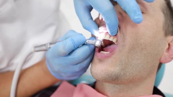 Επαγγελματικός Καθαρισμός Δοντιών Κοντινό Πλάνο Του Γιατρού Οδοντίατρο Κάνει Προληπτική — Αρχείο Βίντεο