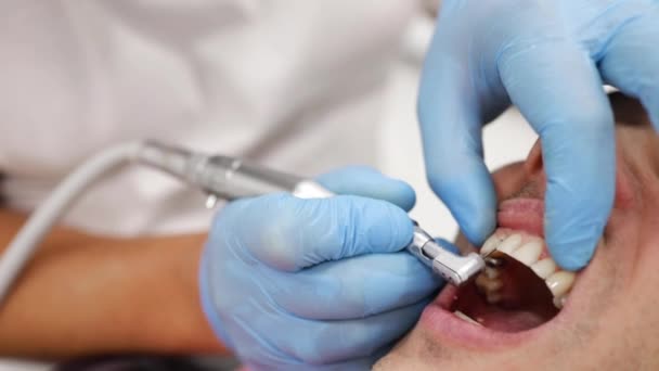 Επαγγελματικός Καθαρισμός Δοντιών Κοντινό Πλάνο Του Γιατρού Οδοντίατρο Κάνει Προληπτική — Αρχείο Βίντεο