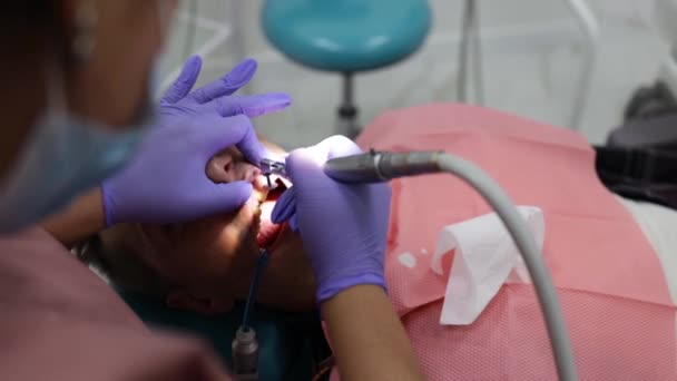 Diş Tedavi Prosedüründe Diş Hekimliği Ofisinde Hasta Dişleri Için Diş — Stok video
