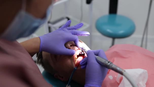 牙科治疗程序中牙科办公室患者牙齿用牙钻的特写 — 图库视频影像